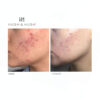 SkinCapsule Clear+ uztura bagātinātājs problemātiskai ādai